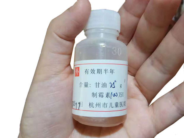寶寶嘴里長了白色斑點(diǎn)，很可能是鵝口瘡